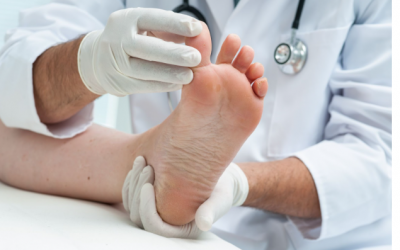 Toes Amputation: Is it Right for You? 5 Signs to Consider
