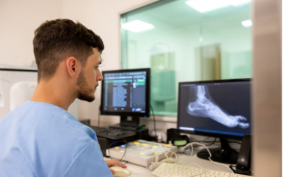 Ankle Fusion vs. Replacement: Which Surgery is Best for You?