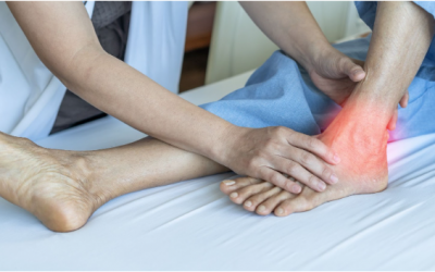 What You Need To Know About Achilles Surgery