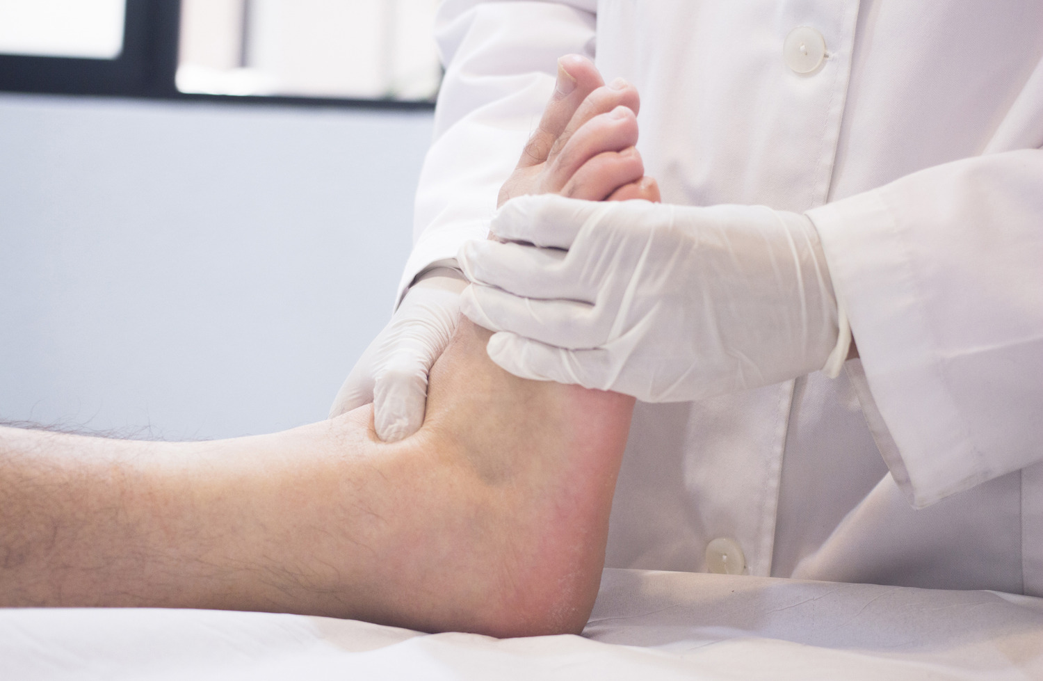 Excision Fracture Fragment of the Foot at Smith Medical Excision Plantar Granuloma Procedure